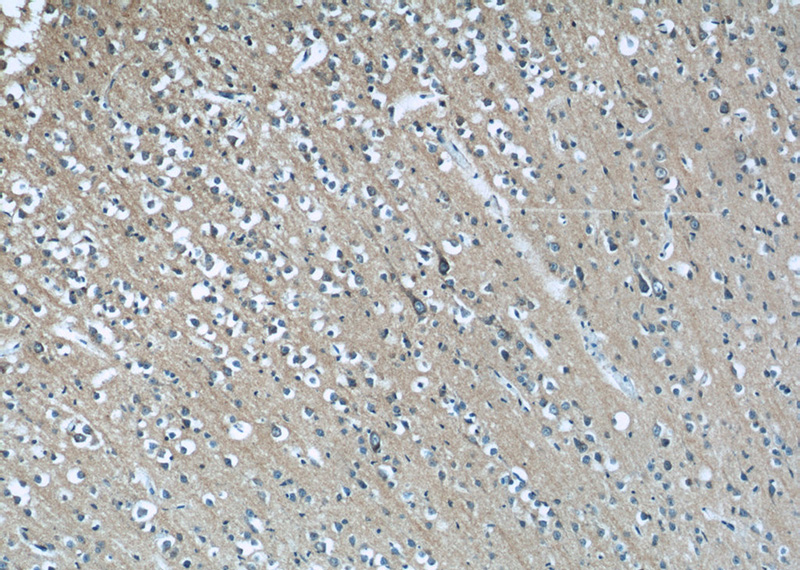 Immunohistochemistry of paraffin-embedded human brain tissue slide using Catalog No:114434(RAB35 Antibody) at dilution of 1:50 (under 10x lens)