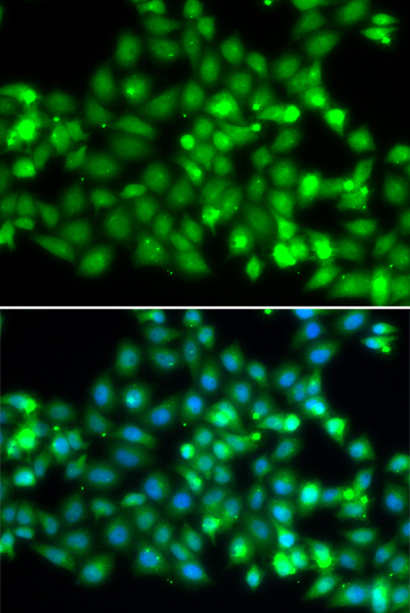 Immunofluorescence - TRIM69 Polyclonal Antibody 