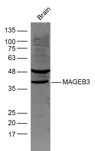 Fig1: Sample:; Brain (Mouse) Lysate at 40 ug; Primary: Anti- MAGEB3 at 1/300 dilution; Secondary: IRDye800CW Goat Anti-Rabbit IgG at 1/20000 dilution; Predicted band size: 39 kD; Observed band size: 39 kD
