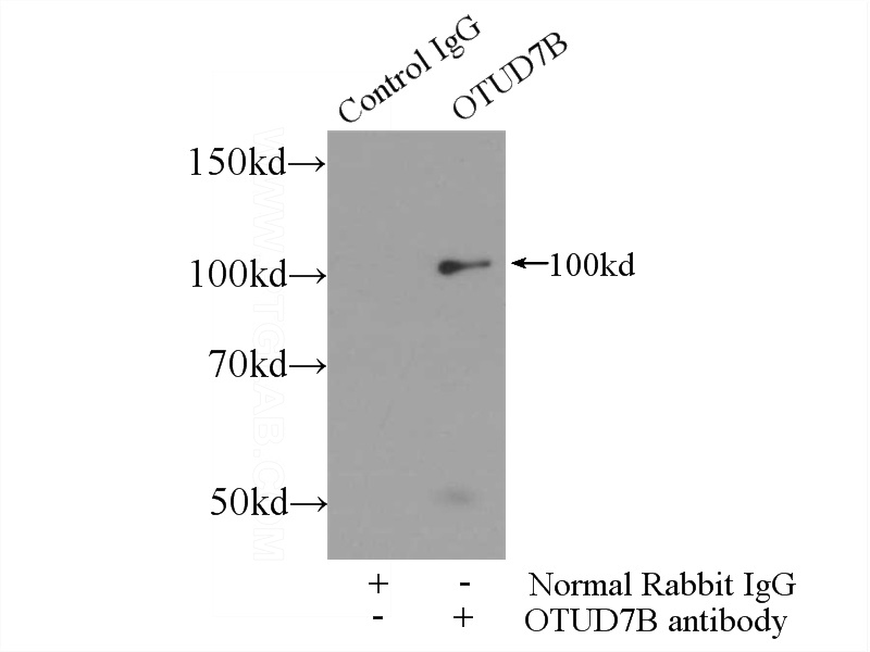 IP Result of anti-OTUD7B (IP:Catalog No:113518, 4ug; Detection:Catalog No:113518 1:800) with Jurkat cells lysate 2500ug.
