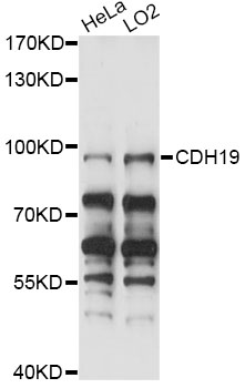 Western blot - CDH19 Polyclonal Antibody 