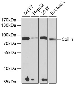 Western blot - Coilin Polyclonal Antibody 