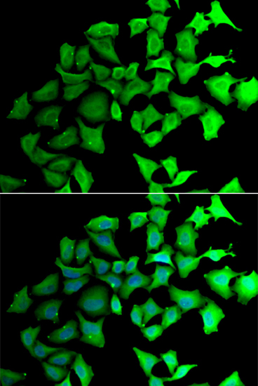 Immunofluorescence - TALDO1 Polyclonal Antibody 