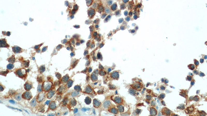 Immunohistochemical of paraffin-embedded human testis using Catalog No:109337(CLDN11 antibody) at dilution of 1:50 (under 40x lens)