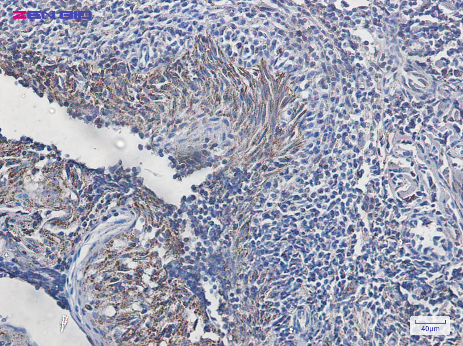 Immunohistochemistry of ATPB in paraffin-embedded Human tonsil using ATPB Rabbit pAb at dilution 1/20