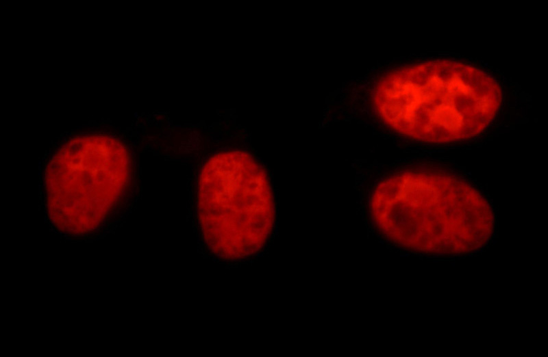 Immunofluorescent analysis of HepG2 cells, using XRCC5 antibody Catalog No:116876 at 1:50 dilution and Rhodamine-labeled goat anti-rabbit IgG (red).