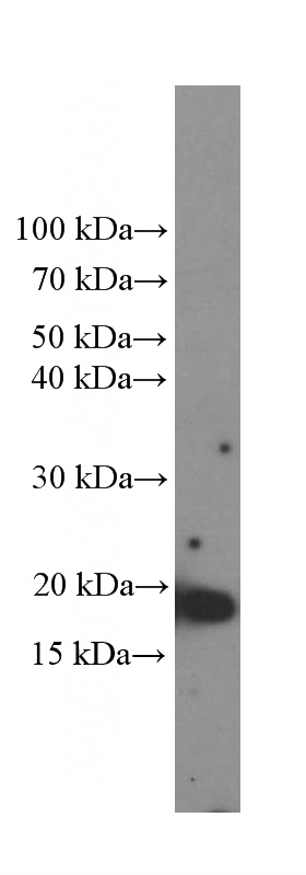 LPS treated RAW 264.7 cells were subjected to SDS PAGE followed by western blot with Catalog No:107629(TNF-a Antibody) at dilution of 1:1000