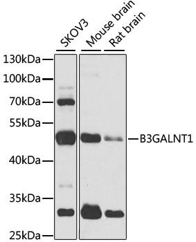 Western blot - B3GALNT1 Polyclonal Antibody 