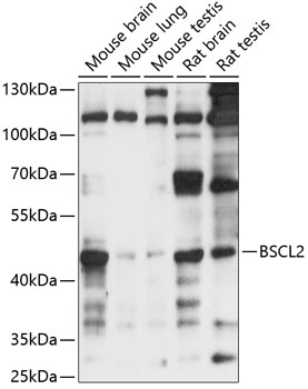 Western blot - BSCL2 Polyclonal Antibody 
