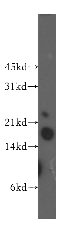 human stomach tissue were subjected to SDS PAGE followed by western blot with Catalog No:116148(TNNC1 antibody) at dilution of 1:500