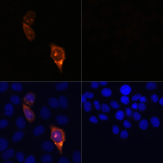 Immunofluorescence - CAS9 Polyclonal Antibody 