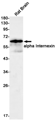 Western blot detection of alpha Internexin in Rat Brain lysates using alpha Internexin Rabbit mAb(1:1000 diluted).Predicted band size:55kDa.Observed band size:55kDa.