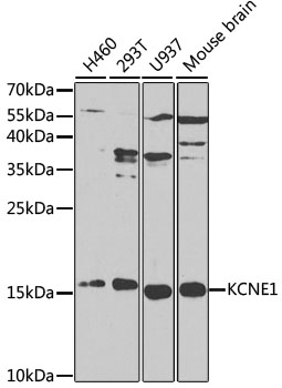 Western blot - KCNE1 Polyclonal Antibody 
