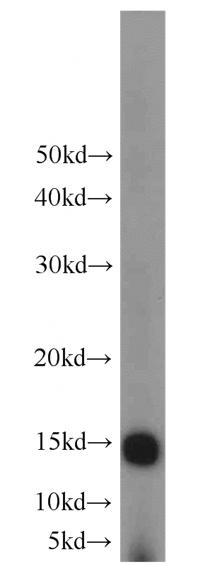rat skeletal muscle tissue were subjected to SDS PAGE followed by western blot with Catalog No:110439(FABP4 antibody) at dilution of 1:600