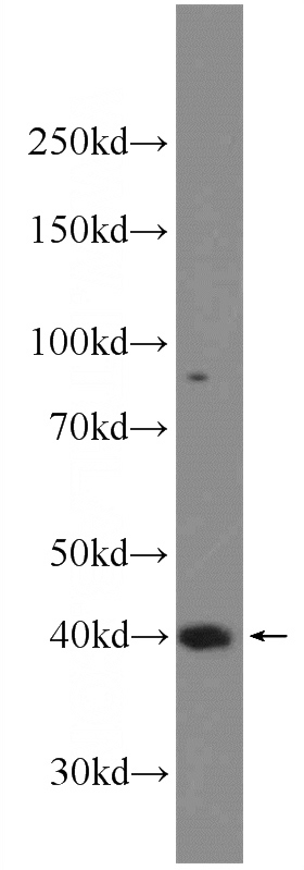 RAW 264.7 cells were subjected to SDS PAGE followed by western blot with Catalog No:115129(SETD8 Antibody) at dilution of 1:600