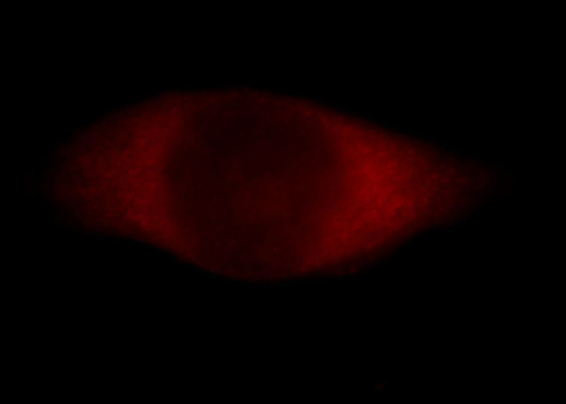 Immunofluorescent analysis of Hela cells, using CALCocO1 antibody Catalog No:108817 at 1:25 dilution and Rhodamine-labeled goat anti-rabbit IgG (red).