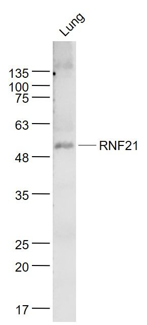 Fig2: Sample:; Lung (Mouse) Lysate at 40 ug; Primary: Anti- RNF21 at 1/1000 dilution; Secondary: IRDye800CW Goat Anti-Rabbit IgG at 1/20000 dilution; Predicted band size: 57kD; Observed band size: 55 kD