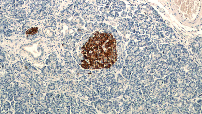 Immunohistochemical of paraffin-embedded human pancreas using Catalog No:109288(CHGA antibody) at dilution of 1:400 (under 10x lens)