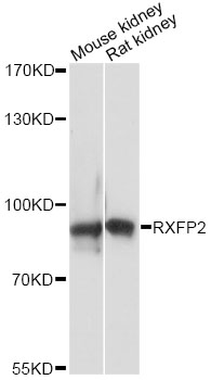 Western blot - RXFP2 Polyclonal Antibody 
