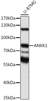 Western blot - ANKK1 Polyclonal Antibody 