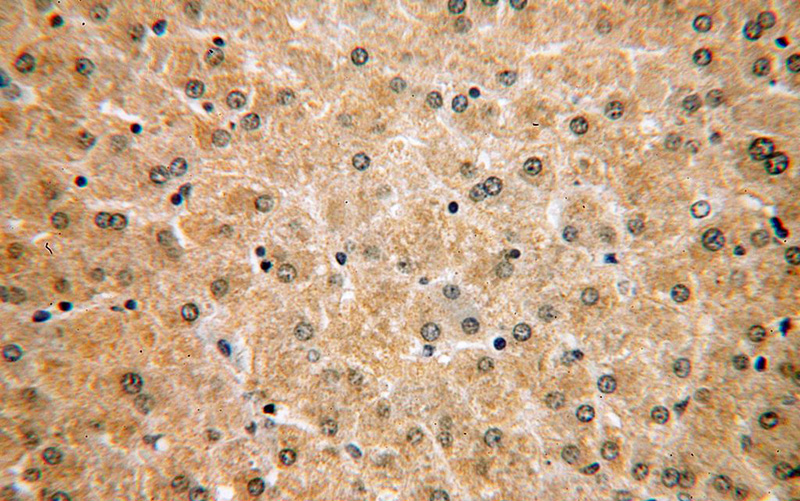 Immunohistochemical of paraffin-embedded human liver using Catalog No:109411(CLYBL antibody) at dilution of 1:50 (under 40x lens)