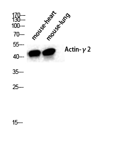 Fig1:; Western Blot analysis of various cells using Actin α3 Polyclonal Antibody diluted at 1: 2000