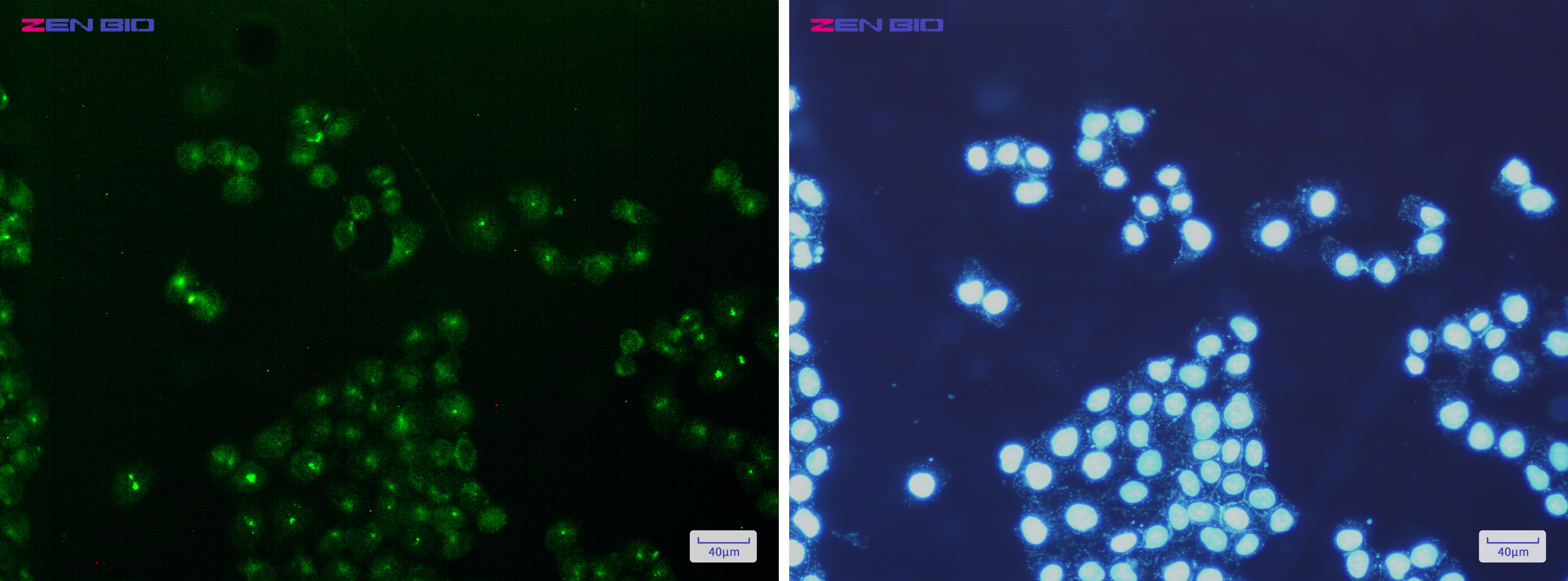 Immunocytochemistry of mtTFA/TFAM(green) in Hela cells using mtTFA/TFAM Rabbit mAb at dilution 1/200, and DAPI(blue)