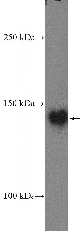 Jurkat cells were subjected to SDS PAGE followed by western blot with Catalog No:114307(PTK7 Antibody) at dilution of 1:1000