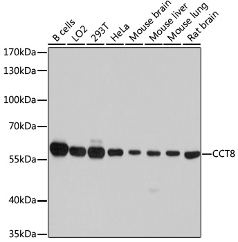 Western blot - CCT8 Polyclonal Antibody 