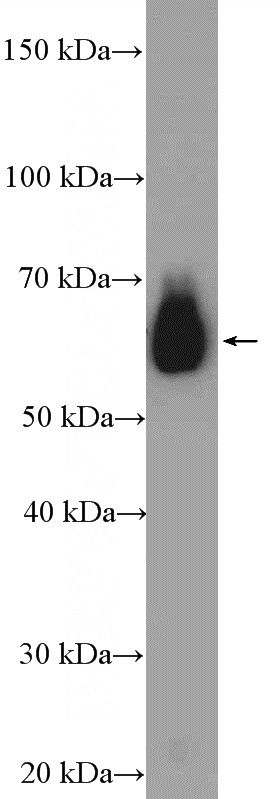 mouse liver tissue were subjected to SDS PAGE followed by western blot with Catalog No:109827(DDX3 Antibody) at dilution of 1:600