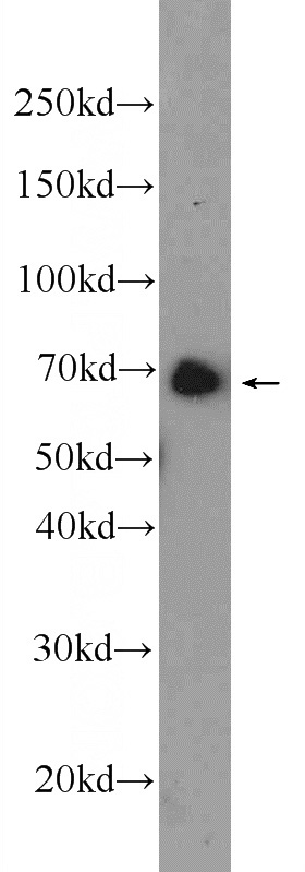 HeLa cells were subjected to SDS PAGE followed by western blot with Catalog No:108081(ANKRD55 Antibody) at dilution of 1:600