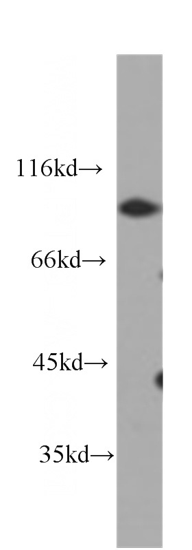 HeLa cells were subjected to SDS PAGE followed by western blot with Catalog No:107136(CD44 antibody) at dilution of 1:1000