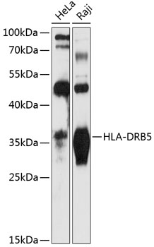 Western blot - HLA-DRB5 Polyclonal Antibody 