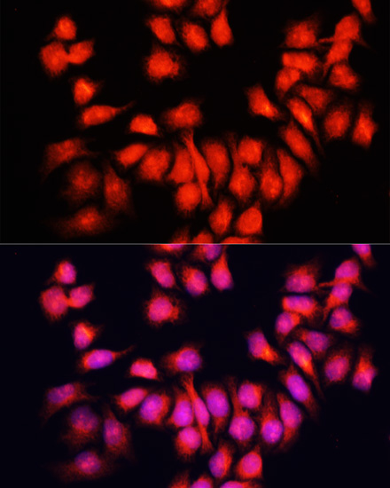 Immunofluorescence - BMP6 Polyclonal Antibody 