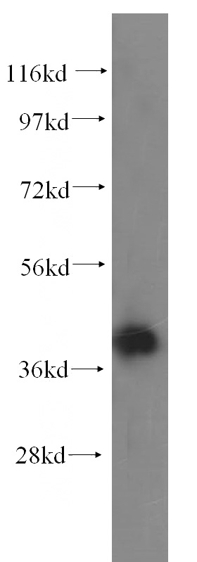 HeLa cells were subjected to SDS PAGE followed by western blot with Catalog No:107976(ALDOA antibody) at dilution of 1:500