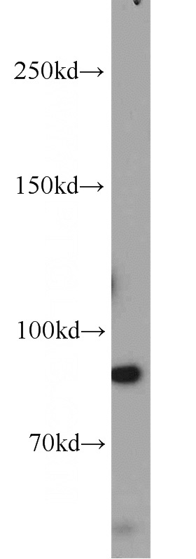 COLO 320 cells were subjected to SDS PAGE followed by western blot with Catalog No:110409(ERCC3 antibody) at dilution of 1:200