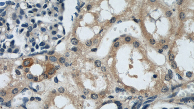 Immunohistochemical of paraffin-embedded human kidney using Catalog No:109359(CNRIP1 antibody) at dilution of 1:50 (under 40x lens)