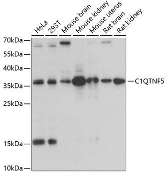 Western blot - C1QTNF5 Polyclonal Antibody 