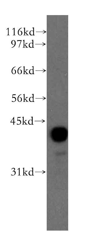 human liver tissue were subjected to SDS PAGE followed by western blot with Catalog No:114132(PPM1A antibody) at dilution of 1:900