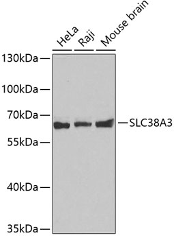Western blot - SLC38A3 Polyclonal Antibody 