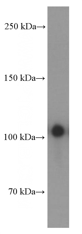 HeLa cells were subjected to SDS PAGE followed by western blot with Catalog No:107255(EPHA1-special Antibody) at dilution of 1:3000