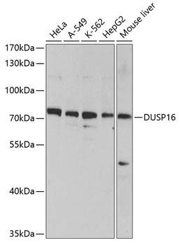 Western blot - DUSP16 Polyclonal Antibody 