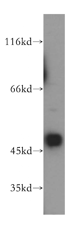 MCF7 cells were subjected to SDS PAGE followed by western blot with Catalog No:112130(KRT33B antibody) at dilution of 1:800
