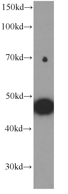 human skeletal muscle tissue were subjected to SDS PAGE followed by western blot with Catalog No:107316(MYOD1 Antibody) at dilution of 1:1000