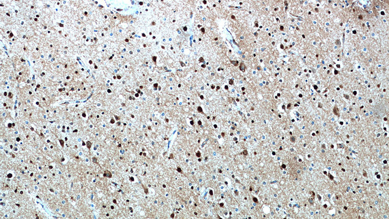 Immunohistochemical of paraffin-embedded human brain using Catalog No:110781(FSD1L antibody) at dilution of 1:50 (under 10x lens)