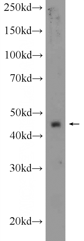 A549 cells were subjected to SDS PAGE followed by western blot with Catalog No:111611(IDO2 Antibody) at dilution of 1:300