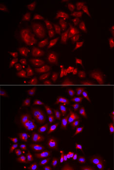 Immunofluorescence - SLC26A2 Polyclonal Antibody 