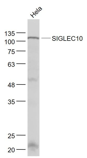 Fig1: Sample:; Hela(Human) Cell Lysate at 30 ug; Primary: Anti- SIGLEC10 at 1/1000 dilution; Secondary: IRDye800CW Goat Anti-Rabbit IgG at 1/20000 dilution; Predicted band size: 77 kD; Observed band size: 102 kD