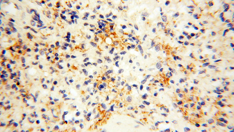 Immunohistochemical of paraffin-embedded human spleen using Catalog No:115052(SAMD4A antibody) at dilution of 1:100 (under 40x lens)