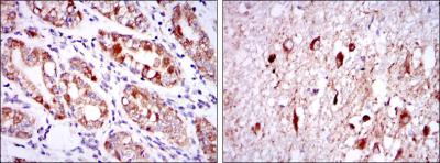 Immunohistochemical analysis of paraffin-embedded stomach tissues (left) and brain tissues (right) using OTX2 mouse mAb with DAB staining.
